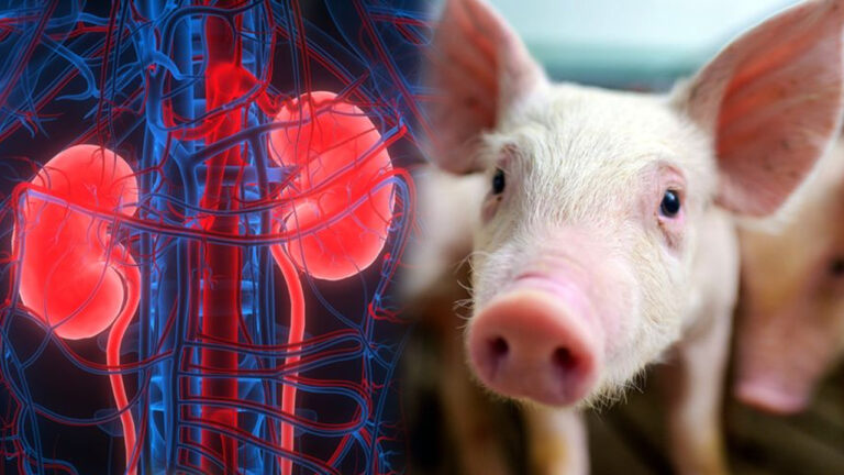 Ilmuwan Sukses Cangkokkan Ginjal Hewan ke Manusia, Tapi Kenapa Harus Babi?